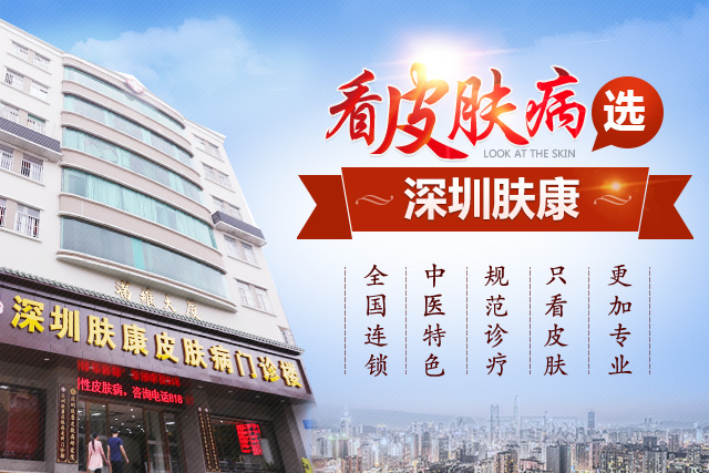 ����ţƤѢ��Ҫ֪����Щ����Ҫע��