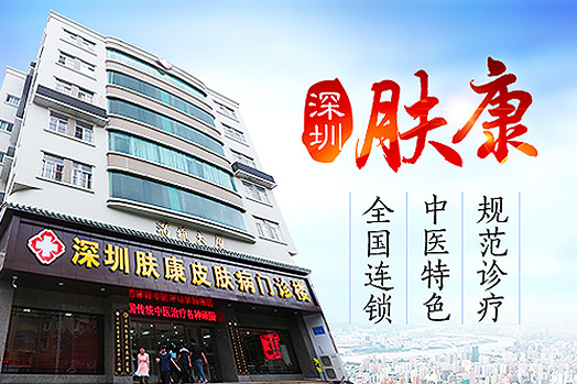 ������м���ļ�Ƥ��ר��ҽԺ����Ч����?������м���ܿ�����?