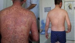 ţƤѢ������ʲôԤ���ķ�ʽ