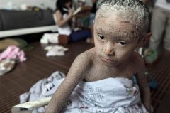 ���۲�������Ҫע��ʲô