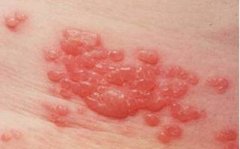 ��״����ᴫȾ��?