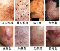 ��ĳ���֢״��������Щ