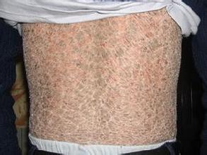 ���۲���֢״������Щ