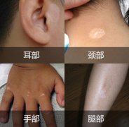 Ԥ���������ȷ��������Щ��