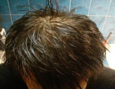 �������ػᵼ�°�ͺ�ķ���