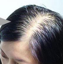 Ů�԰�ͺ��ԭ����ʲô