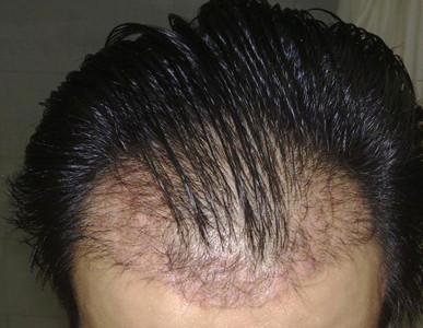 ��ͺ���ߵ��ճ�ע������