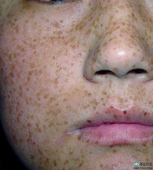 �γɻƺְߵ�ԭ����ʲô