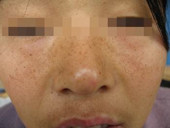 Ů�Իƺְ�����ô������