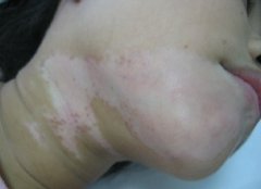 �������֢״����