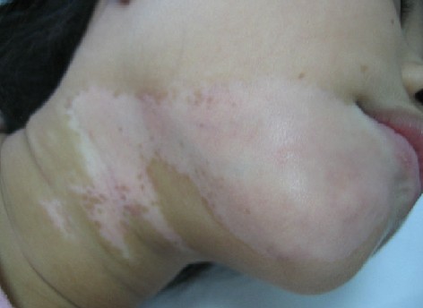 �������֢״����