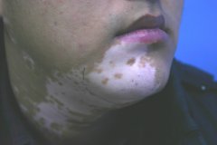 �����������Щ֢״