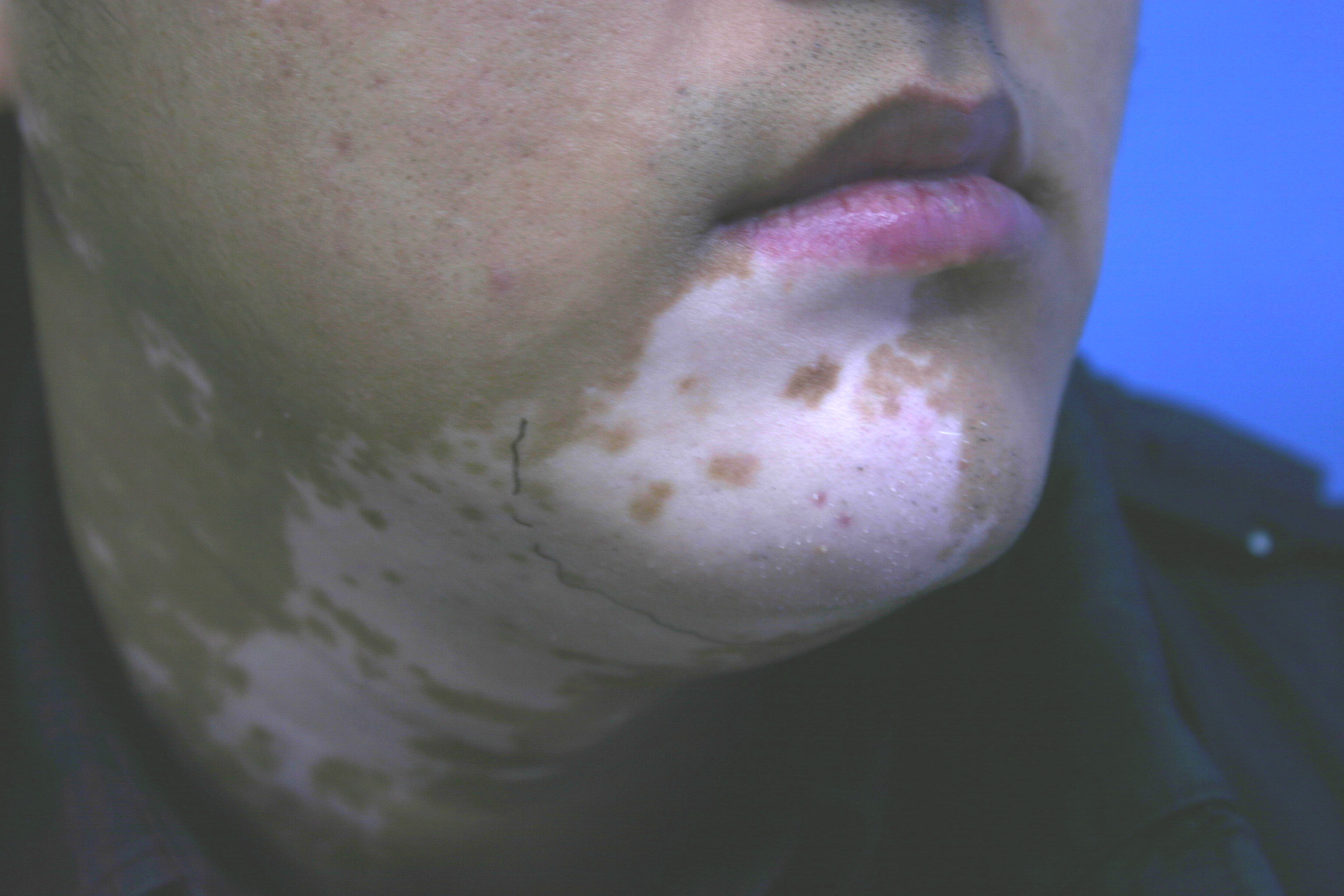 �����������Щ֢״