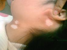 Ů�Ի������ԭ������Щ