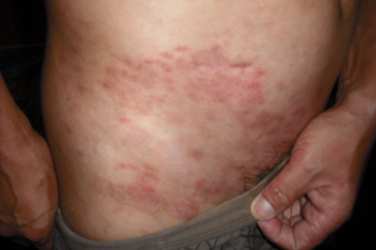 Ƥ�׻��߲��ܳ���Щʳ��