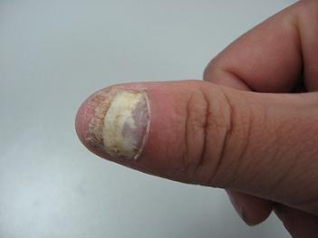 ��ָ�׵ķ�չ�������Ǽ�������