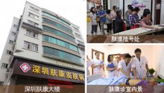 ���ڷ���Ƥ���Ƽ��