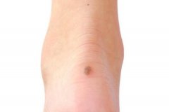 ��ƽ��ľ��岡������Щ